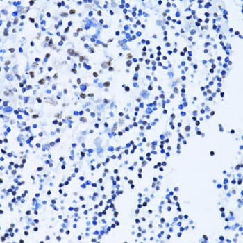 PARP1 Antibody