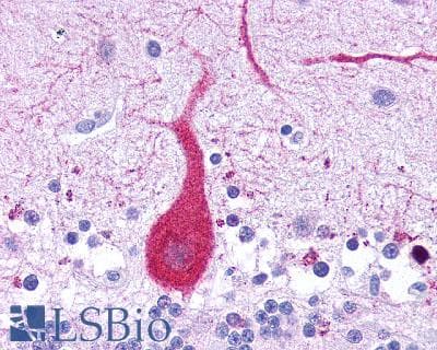PathPlus™ Leukotriene B4 Receptor / BLT1 Antibody (Cytoplasmic Domain)