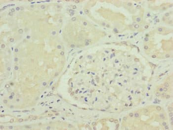 VPS11 Antibody