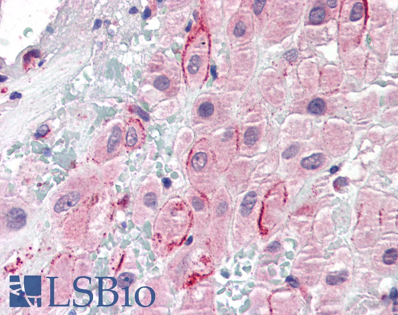 IHC-plus™ Polyclonal Goat anti-Human SPP1 / Osteopontin Antibody (aa288-299, IHC, WB)