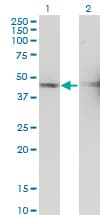 TSSC1 Antibody (clone 2H5)