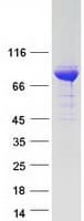 Human ALDH18A1 Protein (Recombinant Myc-DDK (Flag))
