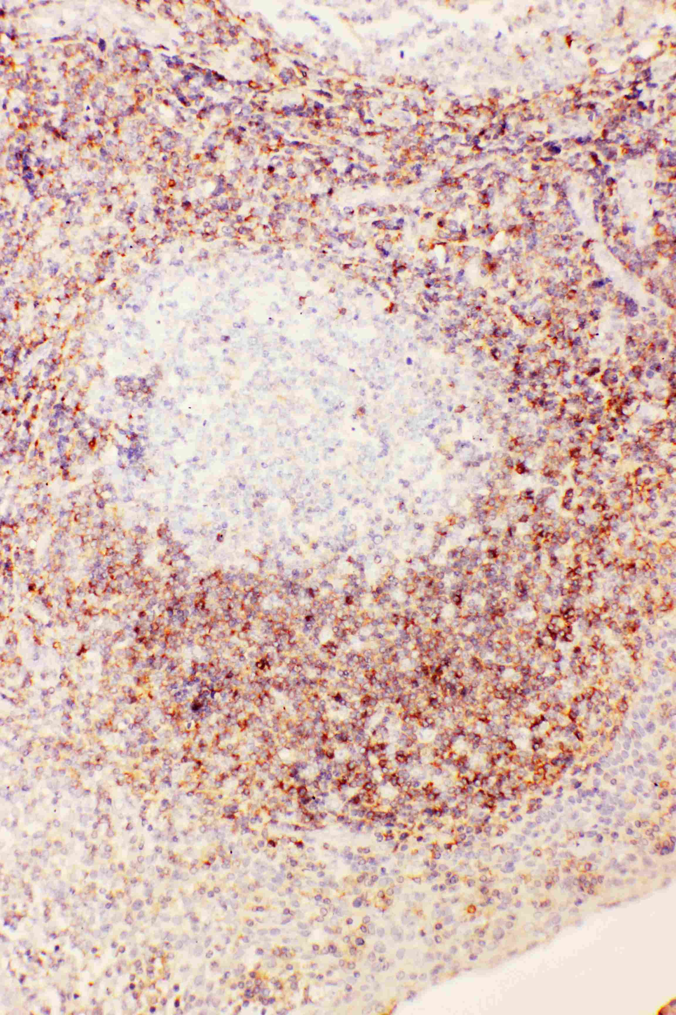 Polyclonal Rabbit anti-Human FAT10 / UBD Antibody (aa27-40, IHC, WB)