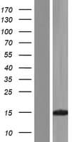 KHDC1L Protein (Over-Expression Lysate Myc-DDK (Flag))