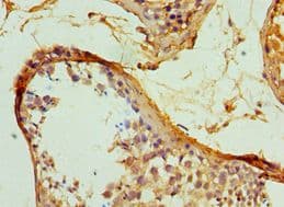 Polyclonal Rabbit anti-Human SERPINH1 / HSP47 Antibody (aa139-418, IHC, WB)