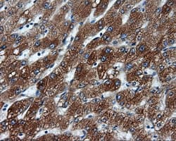 TLDC1 / KIAA1609 Antibody (clone OTI3C4, Carrier-free)