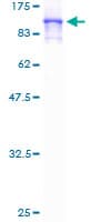 Human TNXB / Tenascin XB Protein (Recombinant GST)