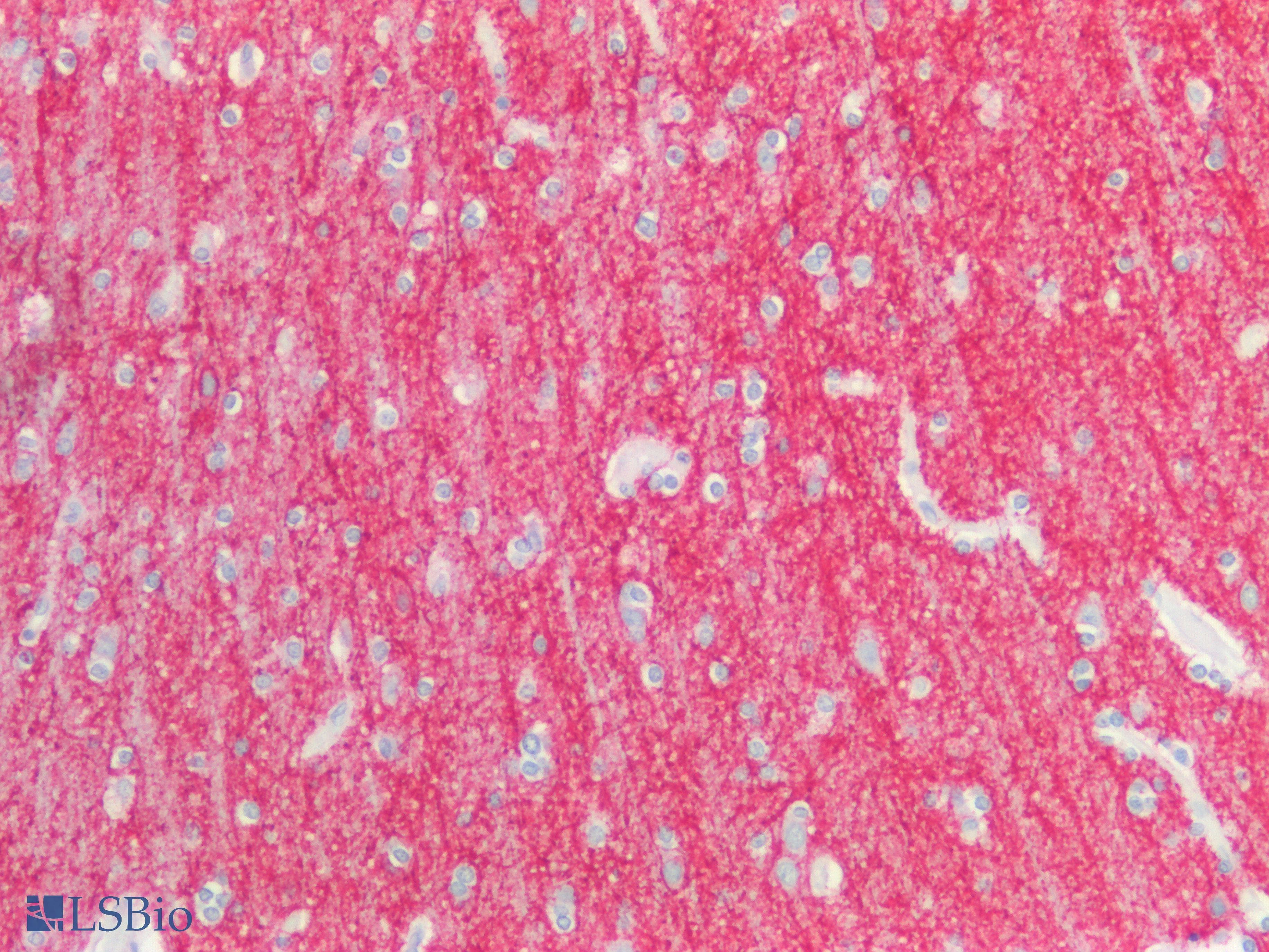 PathPlus™ Polyclonal Rabbit anti-Human ICAM5 / ICAM-5 Antibody (aa409-674, IHC, WB)
