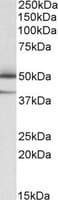 IHC-plus™ TXNDC5 / ERP46 Antibody (aa269-282)
