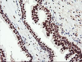 ENPEP / Aminopeptidase A Antibody (clone OTI4G8)