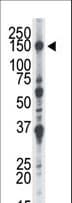 NEK1 Antibody (aa1165-1196)