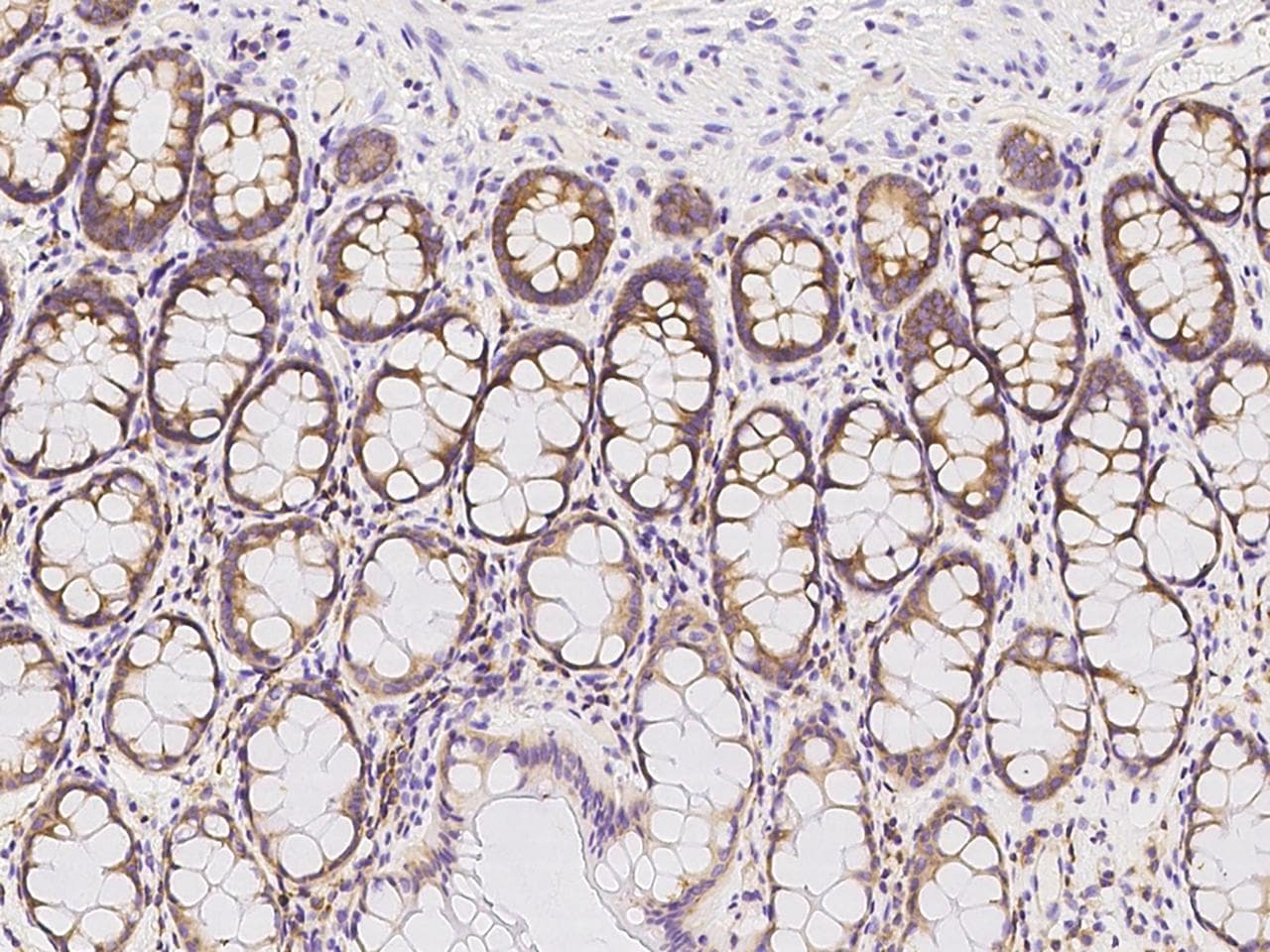 RPL14 / Ribosomal Protein L14 Antibody