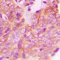 FRK Antibody (Internal)