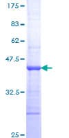 Human TNNI3K / CARK Protein (Recombinant GST, N-terminus)