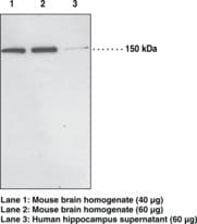 Polyclonal Rabbit anti-Human SCOP / PHLPP Antibody (IHC, WB)