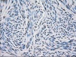PSMA7 Antibody (clone OTI2A7, Carrier-free)