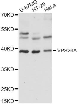 VPS26A / VPS26 Antibody