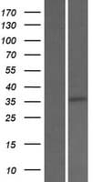SRD5A2L / SRD5A3 Protein (Over-Expression Lysate Myc-DDK (Flag))