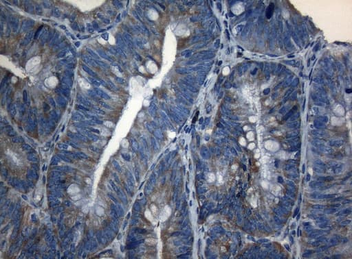 AKT1 Antibody (clone OTI1D12, Carrier-free)