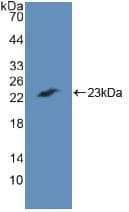 CASP7 / Caspase 7 Antibody (aa24-198)