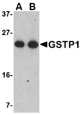 IHC-plus™ GSTP1 / GST Pi Antibody