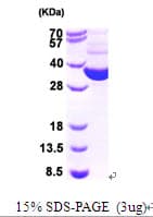 E. coli Thioredoxin Reductase Protein (Recombinant)