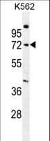IHC-plus™ Polyclonal Rabbit anti-Human SMPD1 / Acid Sphingomyelinase Antibody (aa391-419, IHC, WB)