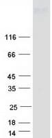 Human HPTPB / PTPRB Protein (Recombinant Myc-DDK (Flag))