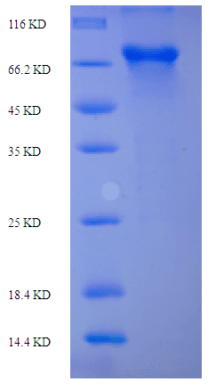 Rat PLBD2 Protein (Recombinant His-SUMO)