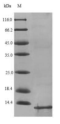 Staphylococcus aureus ACPP / PAP Protein (Recombinant GST, N-terminus)