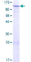 Human TSGA10 Protein (Recombinant GST)