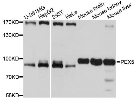Polyclonal Rabbit anti-Human PEX5 Antibody (WB)