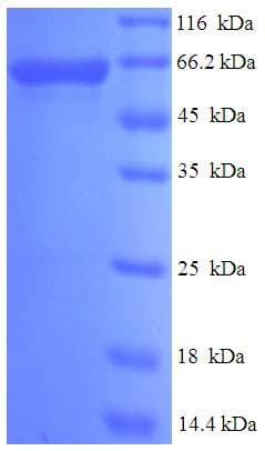 Human PAK4 Protein (Recombinant His-SUMO)