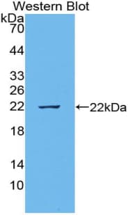 TNFSF15 / TL1A / VEGI Antibody (aa70-230, FITC)