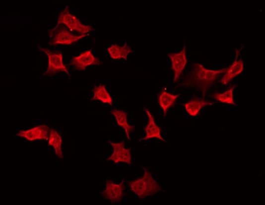 TSSC1 Antibody