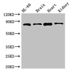 Polyclonal Rabbit anti-Human ABCB9 Antibody (IF, WB)