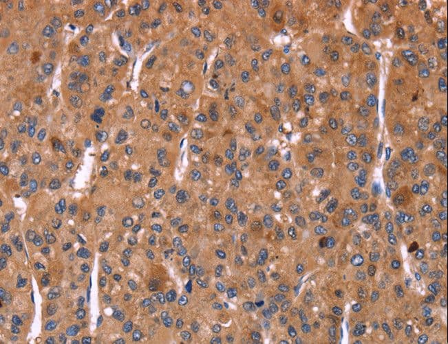 HMGCS1 / HMG-CoA Synthase 1 Antibody
