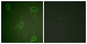 APP / Beta Amyloid Precursor Antibody (phospho-Thr743/Thr668)