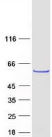 Human LRRC6 Protein (Recombinant Myc-DDK (Flag))