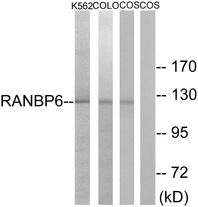 IHC-plus™ Polyclonal Rabbit anti-Human RANBP6 Antibody (aa800-849, IHC, WB)