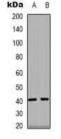 PPM1K Antibody (Internal)