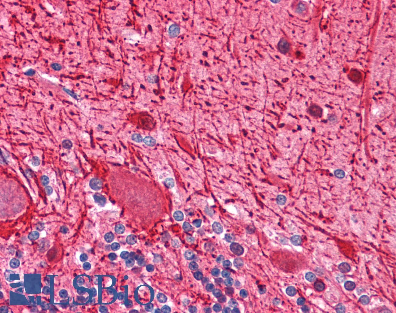 IHC-plus™ Monoclonal Mouse anti-Human NEFH / NF-H Antibody (clone NF-05, IHC, WB)