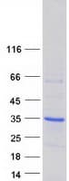 Human SHOX Protein (Recombinant Myc-DDK (Flag))