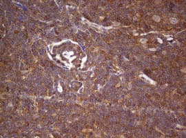 Monoclonal Mouse anti-Human ARFL3 / ARL3 Antibody (clone OTI1C6, aa2-182, IHC, WB)