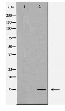 CYB5A / Cytochrome b5 Antibody