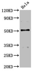 Polyclonal Rabbit anti-Human BCKDHA / BCKDE1A Antibody (IHC, WB)