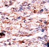 PSKH1 Antibody (aa55-91)