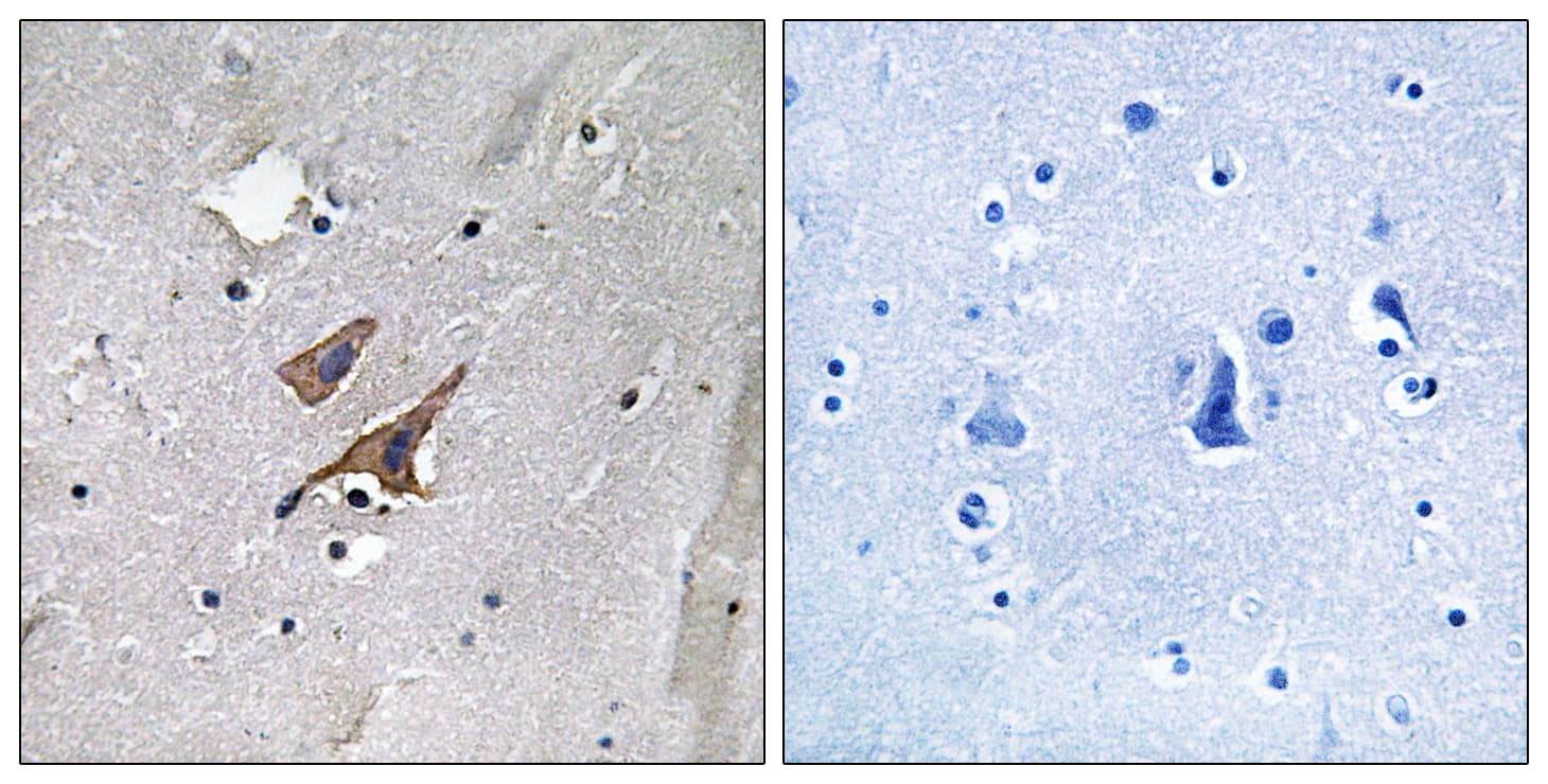 Tuberin / TSC2 Antibody (phospho-Tyr1571)