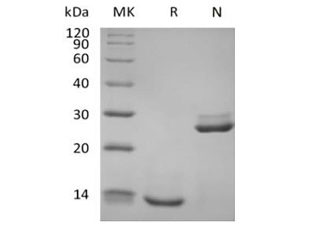 Human TGFB1 / TGF Beta 1 Protein (Recombinant His-AVI, N-terminus)
