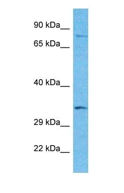 SNX29 / RUNDC2A Antibody (N-Terminus)